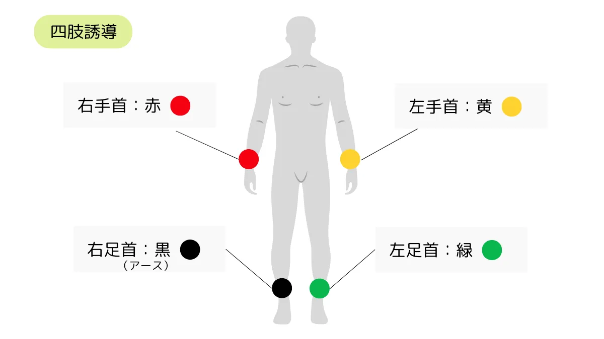 十 二 誘導 心電図