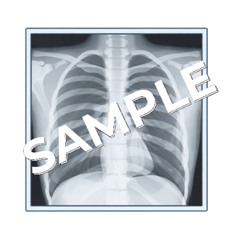 レントゲン写真（胸部）のイラスト