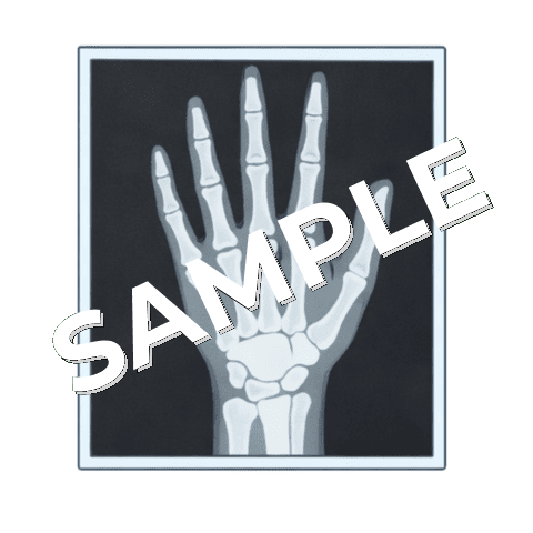 レントゲン写真（手）のイラスト