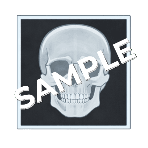 レントゲン写真（頭部）のイラスト