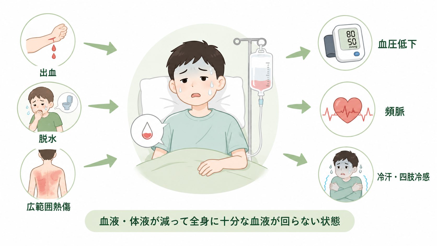 出血 性 ショック